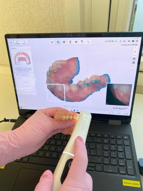 Prothèses dentaires à Bussigny