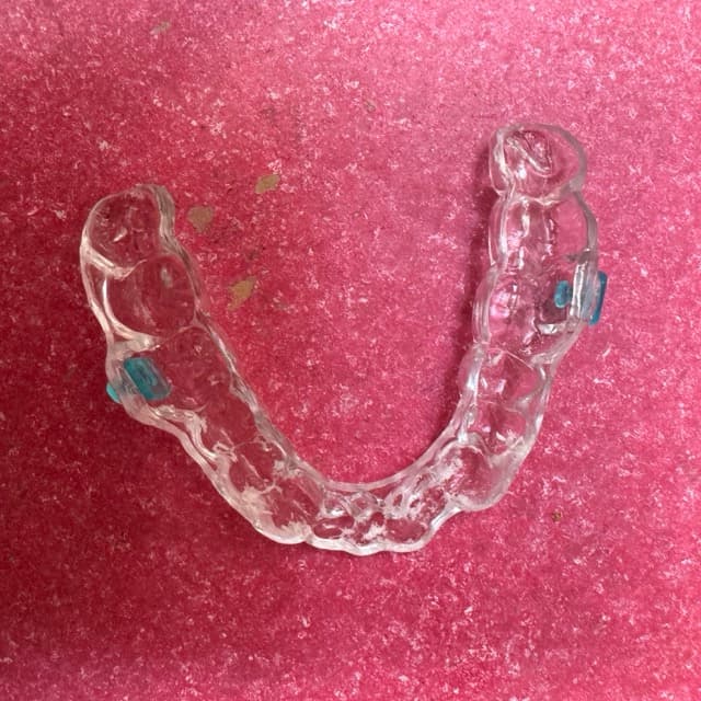 Gouttières dentaires à Bussigny