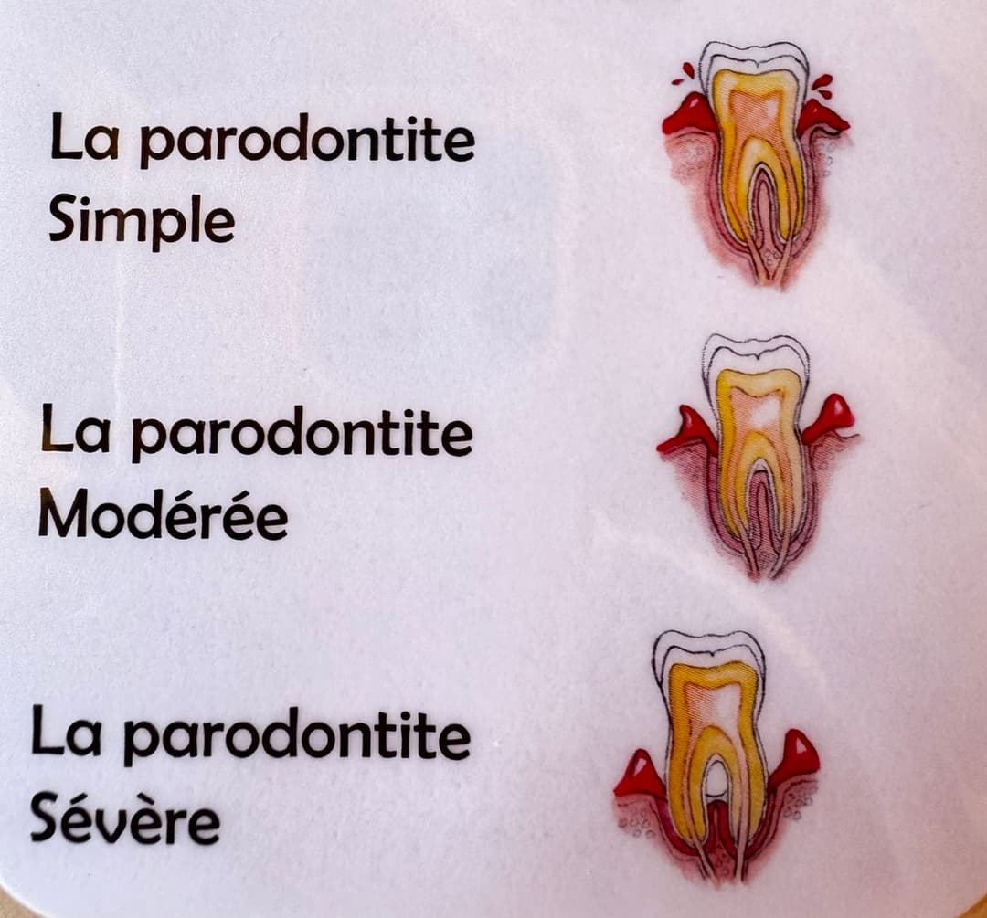 Parodontologie à Bussigny