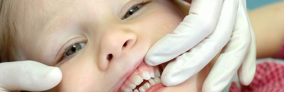 Soins dentaires pour les enfants et les petits